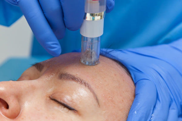 PRP Vampire Facial